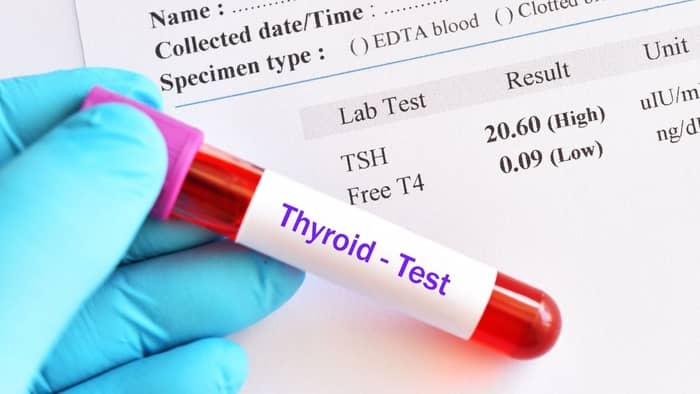  blood test for thyroid